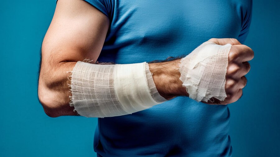 Personal Injury